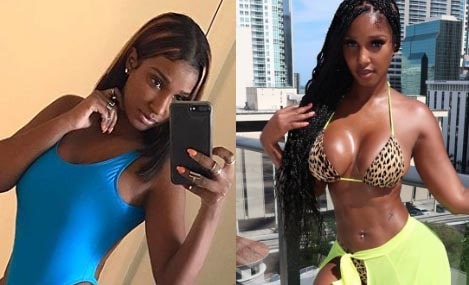 Bernice Burgos breast before and after.